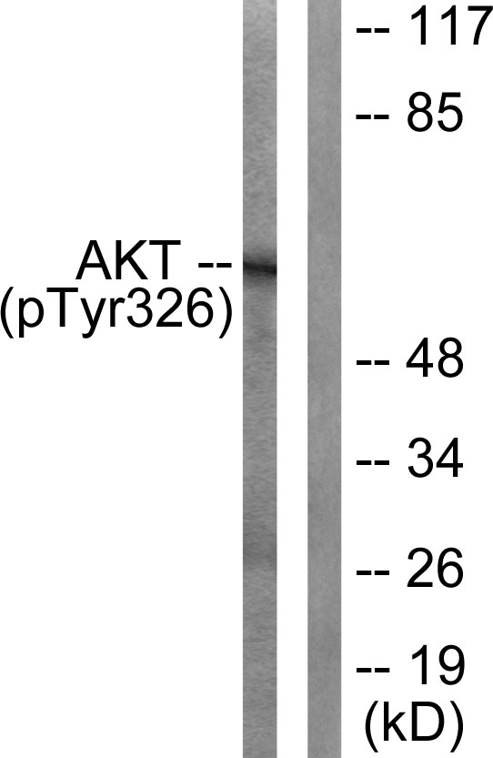 Rabbit Polyclonal Antibody to Akt (Phospho-Tyr326)