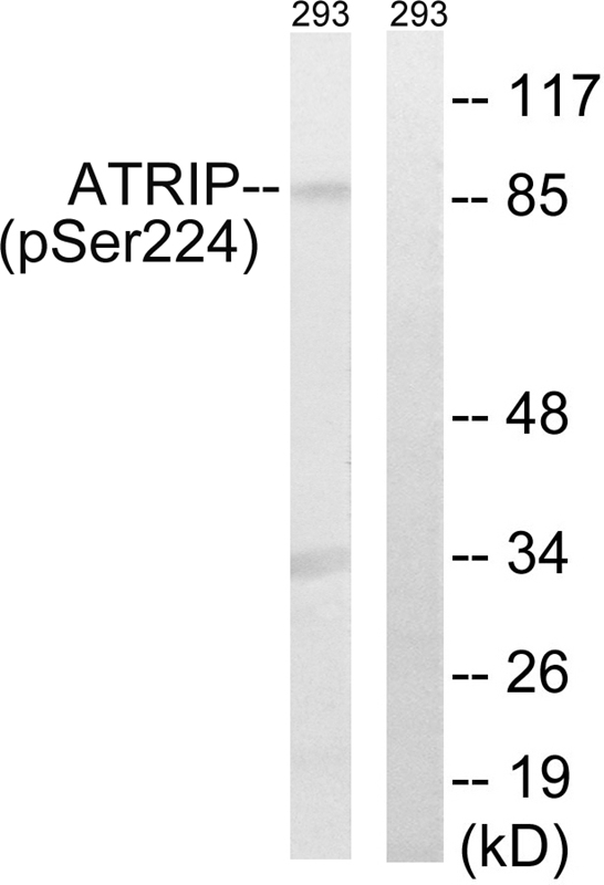 Rabbit Polyclonal Antibody to ATRIP (Phospho-Ser224)