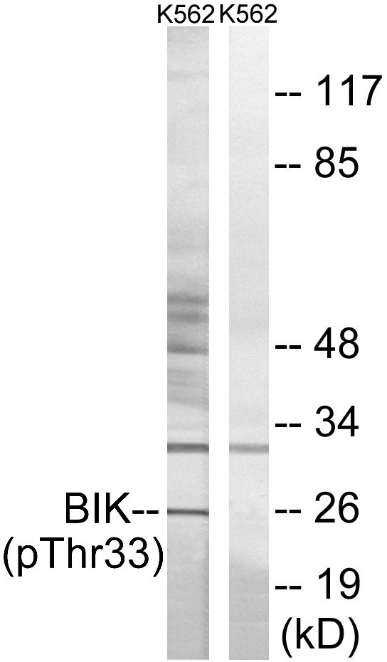 Rabbit Polyclonal Antibody to BIK (Phospho-Thr33)