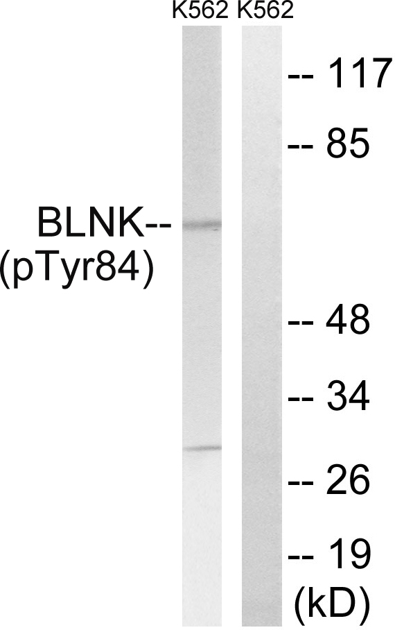 Rabbit Polyclonal Antibody to BLNK (Phospho-Tyr84)