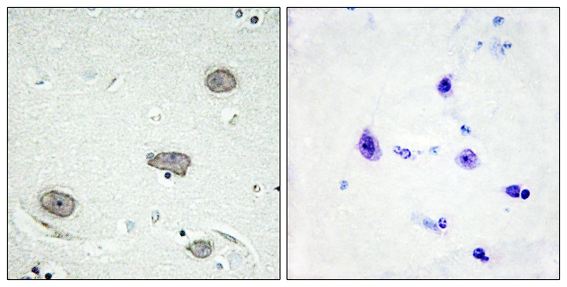 Rabbit Polyclonal Antibody to CSFR (Phospho-Tyr809)
