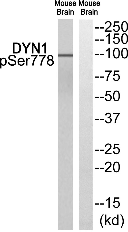Rabbit Polyclonal Antibody to DYN1 (Phospho-Ser778)