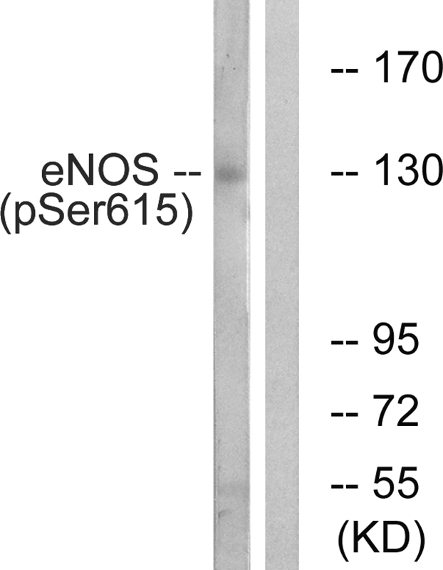 Rabbit Polyclonal Antibody to eNOS (Phospho-Ser615)