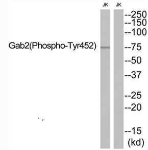 Rabbit Polyclonal Antibody to Gab2 (Phospho-Tyr452)