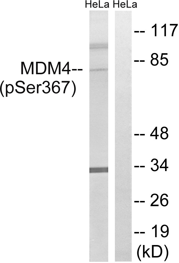 Rabbit Polyclonal Antibody to MDM4 (Phospho-Ser367)