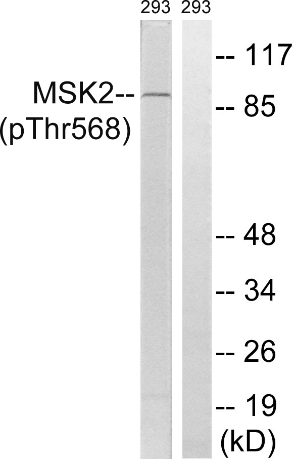 Rabbit Polyclonal Antibody to MSK2 (Phospho-Thr568)