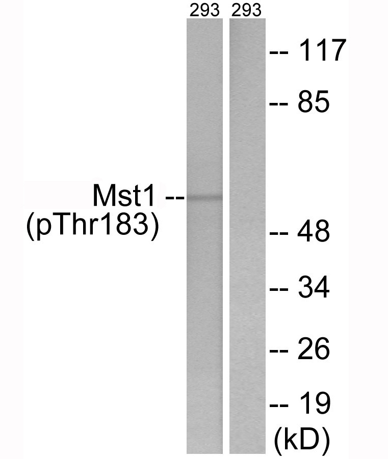 Rabbit Polyclonal Antibody to Mst1 (Phospho-Thr183)
