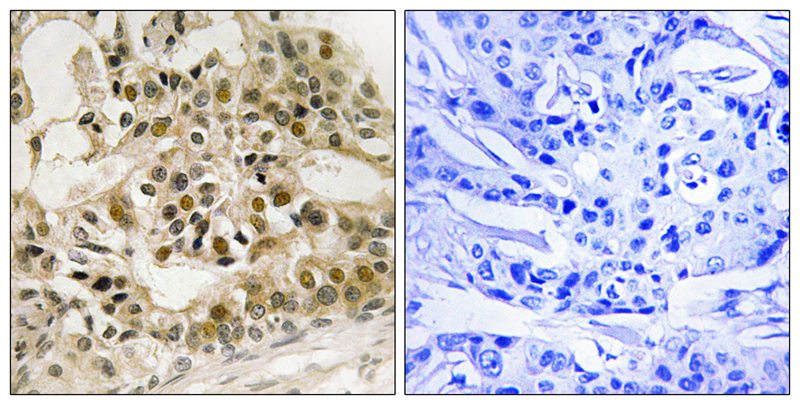 Rabbit Polyclonal Antibody to Myb (Phospho-Ser532)