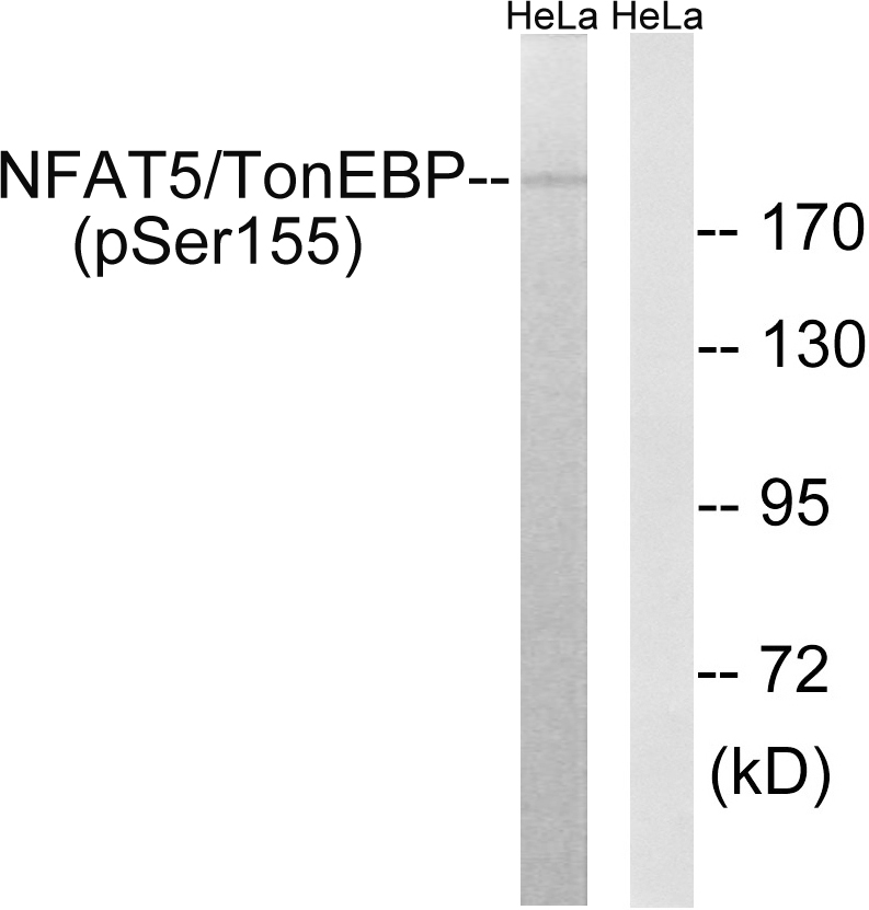 Rabbit Polyclonal Antibody to NFAT5/TonEBP (Phospho-Ser155)
