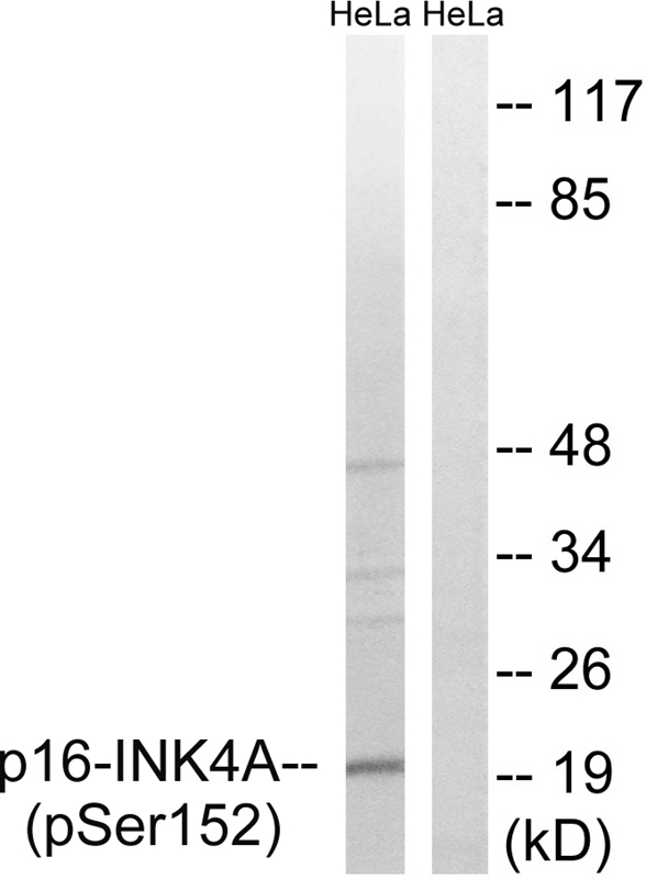 Rabbit Polyclonal Antibody to p16-INK4a (Phospho-Ser152)