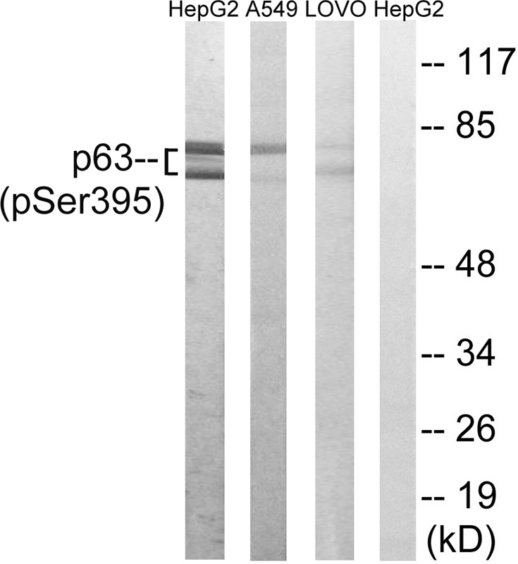 Rabbit Polyclonal Antibody to p63 (Phospho-Ser395)