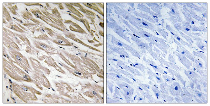 Rabbit Polyclonal Antibody to PPP1R2 (Phospho-Ser120/Ser121)