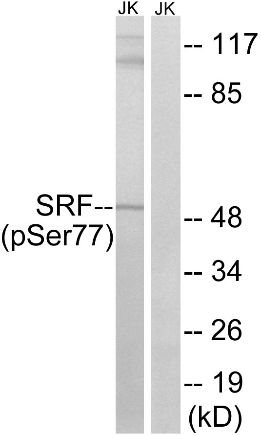 Rabbit Polyclonal Antibody to SRF (Phospho-Ser77)