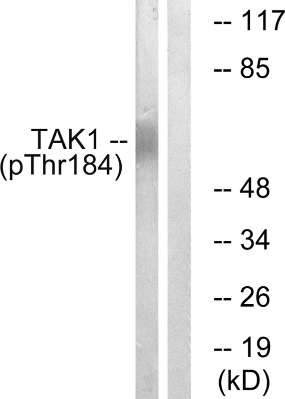Rabbit Polyclonal Antibody to TAK1 (Phospho-Thr184)