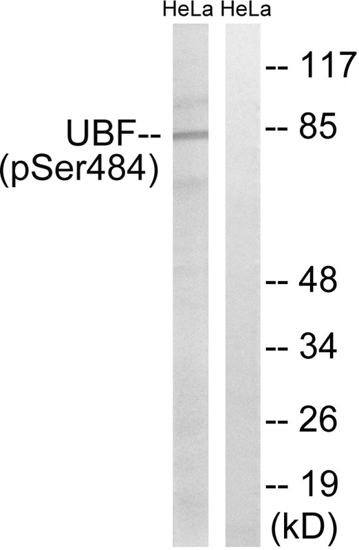 Rabbit Polyclonal Antibody to UBF (Phospho-Ser484)