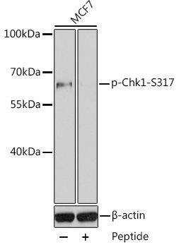Rabbit Polyclonal Antibody to CHEK1(Phospho-Ser317)