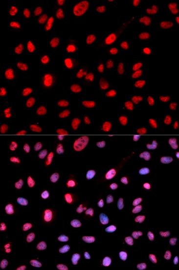 Rabbit Polyclonal Antibody to Dnmt1(Phospho-Ser714)