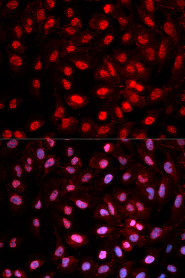 Rabbit Polyclonal Antibody to Dnmt1(Phospho-Tyr399)