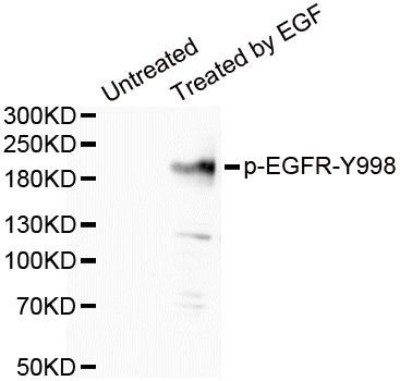 Rabbit Polyclonal Antibody to EGFR(Phospho-Tyr998)