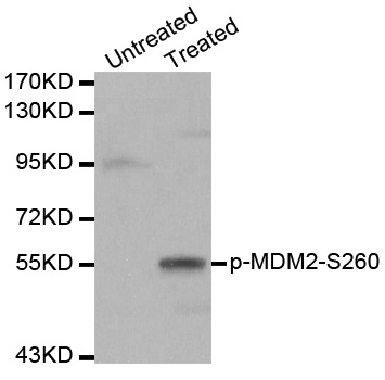 Rabbit Polyclonal Antibody to MDM2(Phospho-Ser260)