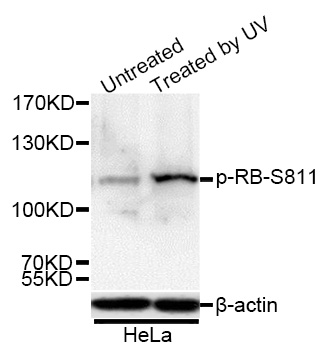 Rabbit Polyclonal Antibody to RB(Phospho-Ser811)