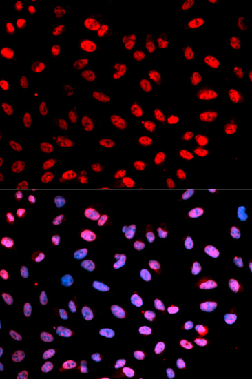 Rabbit Polyclonal Antibody to ESPL1(Phospho-S1126/801)