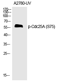 Rabbit Polyclonal Antibody to Cdc25A (Phospho-Ser75)