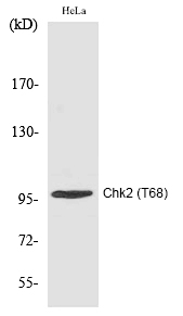 Rabbit Polyclonal Antibody to Chk2 (Phospho-Thr68)