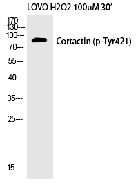 Rabbit Polyclonal Antibody to Cortactin (Phospho-Tyr421)