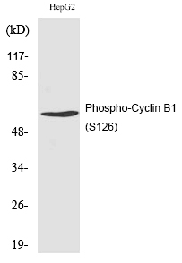 Rabbit Polyclonal Antibody to Cyclin B1 (Phospho-Ser126)