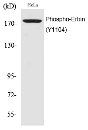 Rabbit Polyclonal Antibody to Erbin (Phospho-Tyr1104)