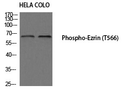 Rabbit Polyclonal Antibody to Ezrin (Phospho-Thr566)