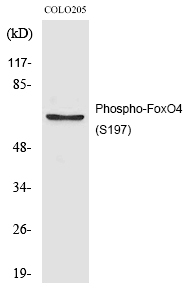 Rabbit Polyclonal Antibody to FoxO4 (Phospho-Ser197)