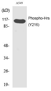Rabbit Polyclonal Antibody to Hrs (Phospho-Tyr216)