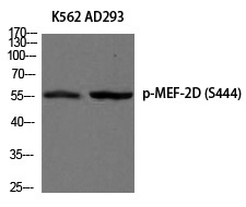 Rabbit Polyclonal Antibody to MEF-2D (Phospho-Ser444)