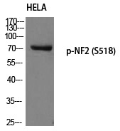 Rabbit Polyclonal Antibody to NF2 (Phospho-Ser518)