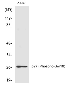 Rabbit Polyclonal Antibody to p27 (Phospho-Ser10)