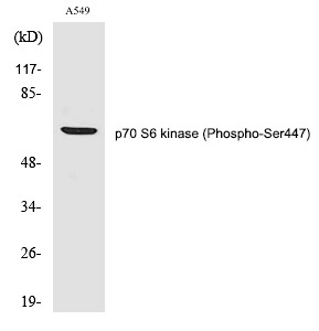 Rabbit Polyclonal Antibody to p7S6 kinase α (Phospho-Ser447)