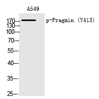 Rabbit Polyclonal Antibody to Pragmin (Phospho-Tyr413)