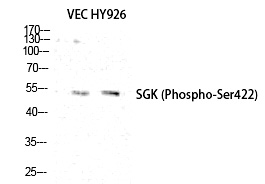 Rabbit Polyclonal Antibody to SGK1 (Phospho-Ser422)