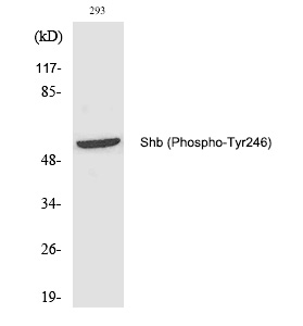 Rabbit Polyclonal Antibody to Shb (Phospho-Tyr246)