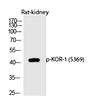 Rabbit Polyclonal Antibody to KOR-1 (Phospho-Ser369)