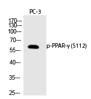 Rabbit Polyclonal Antibody to PPAR-γ (Phospho-Ser112)