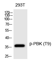 Rabbit Polyclonal Antibody to PBK (Phospho-Thr9)
