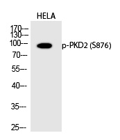 Rabbit Polyclonal Antibody to PKD2 (Phospho-Ser876)