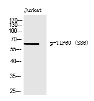 Rabbit Polyclonal Antibody to TIP6(Phospho-Ser86)