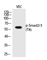 Rabbit Polyclonal Antibody to Smad2/3 (Phospho-Thr8)