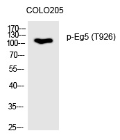 Rabbit Polyclonal Antibody to Eg5 (Phospho-Thr926)