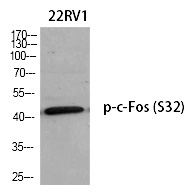 Rabbit Polyclonal Antibody to c-Fos (Phospho-Ser32)