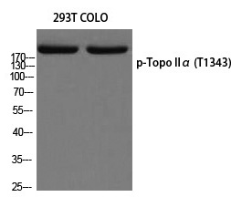 Rabbit Polyclonal Antibody to Topo IIα (Phospho-Thr1343)